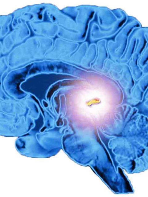 Cara Aktivasi Pineal Gland